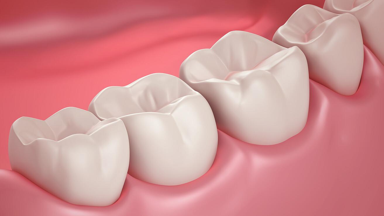 Animated rendering of teeth and gum