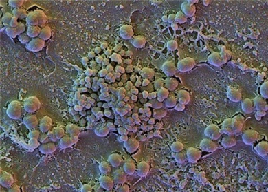 Microscopic view of biofilm in mouth