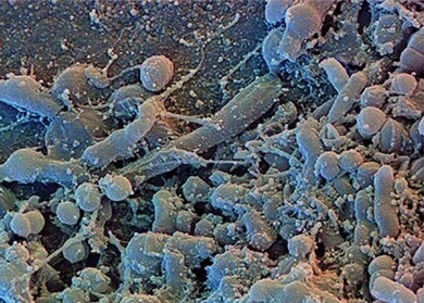 Microscopic view of biofilm