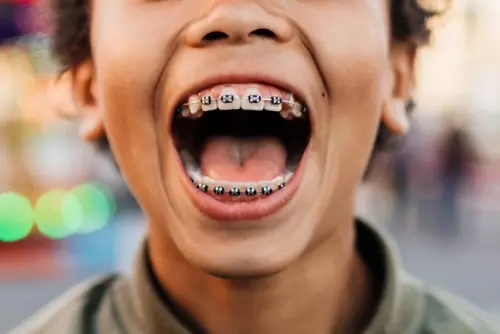 Boy with metal braces smiling